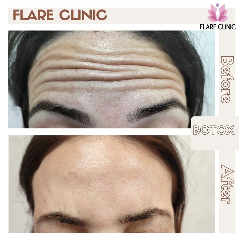 Clinic Results Gallery